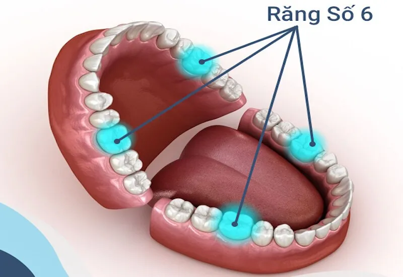 Răng hàm số 6 là răng nào