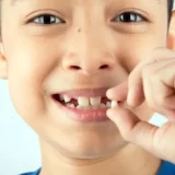 Những răng trẻ em sẽ thay
