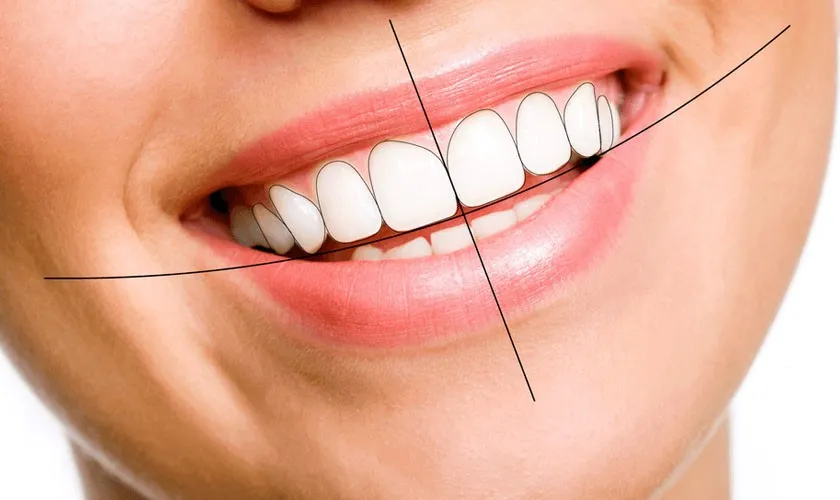 khớp cắn ngược